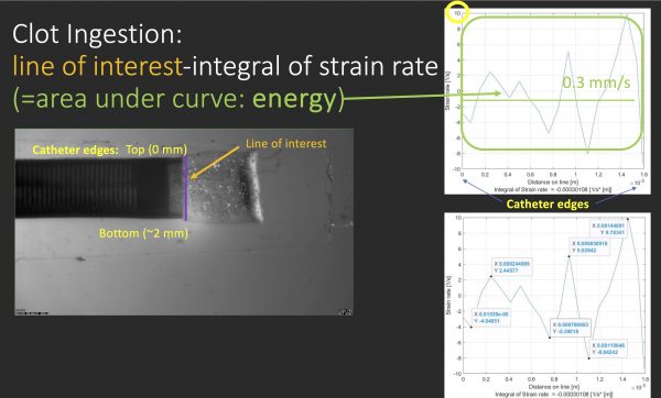 Clot ingestion line of interest strain rate image.